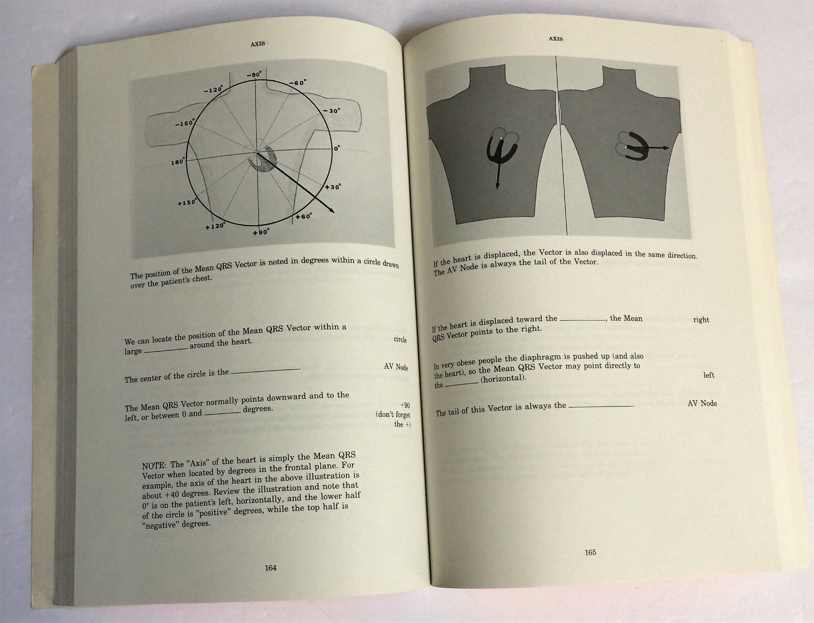 1991 Rapid Interpretation of EKGs Fourth Edition By Dale Dubin ...