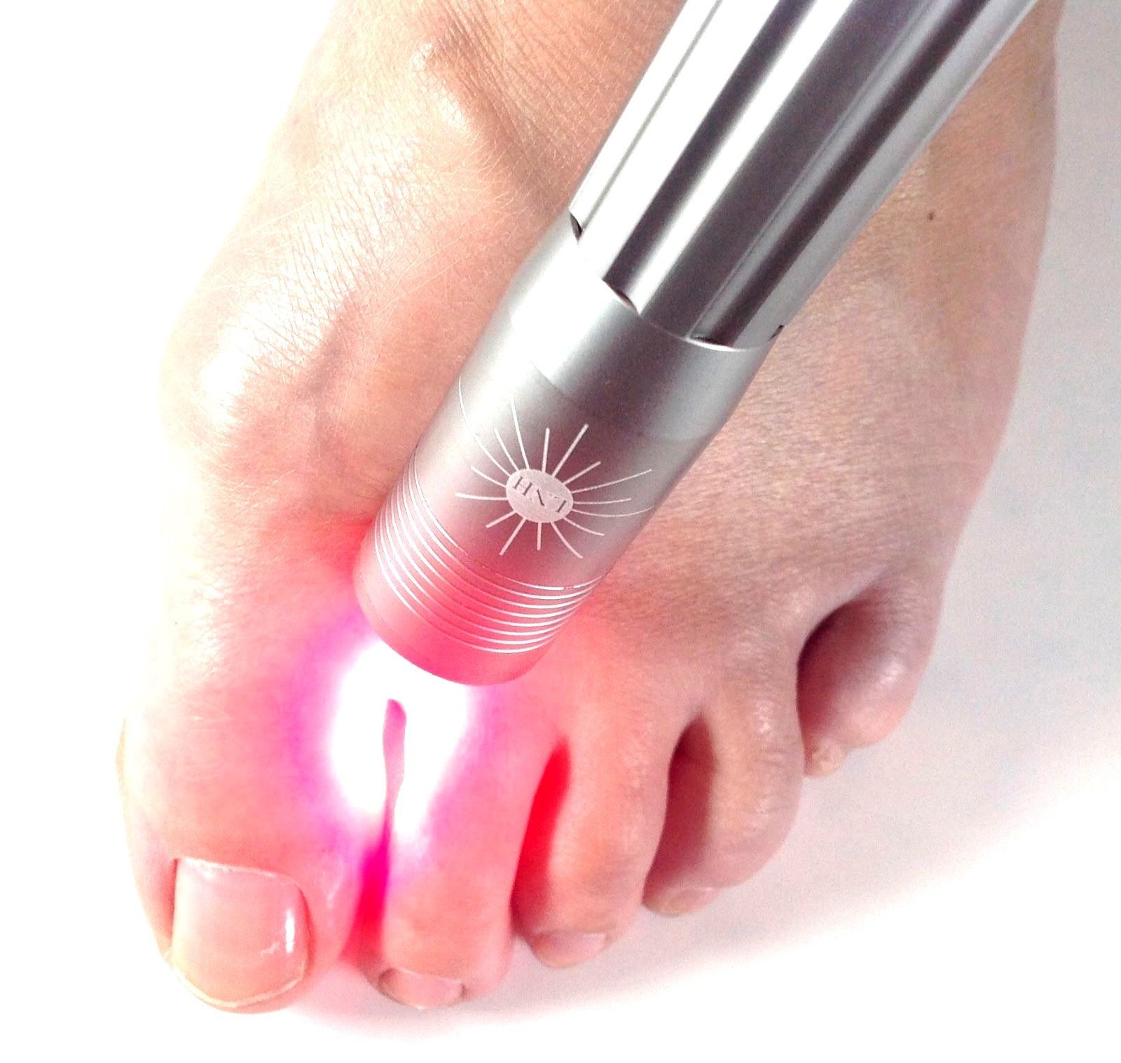 Cold Laser Therapy Kit. Deep Relief for Diabetic Neuropathic Ulcers