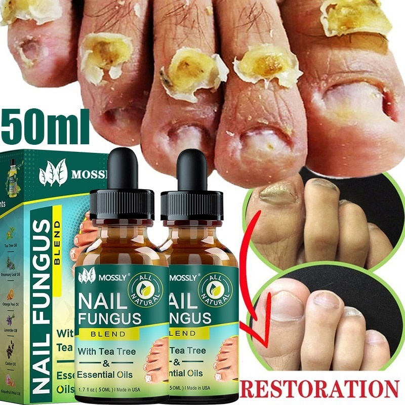 Nail Fungal Repair Treatment Serum Onychomycosis Paronychia Foot Care ...