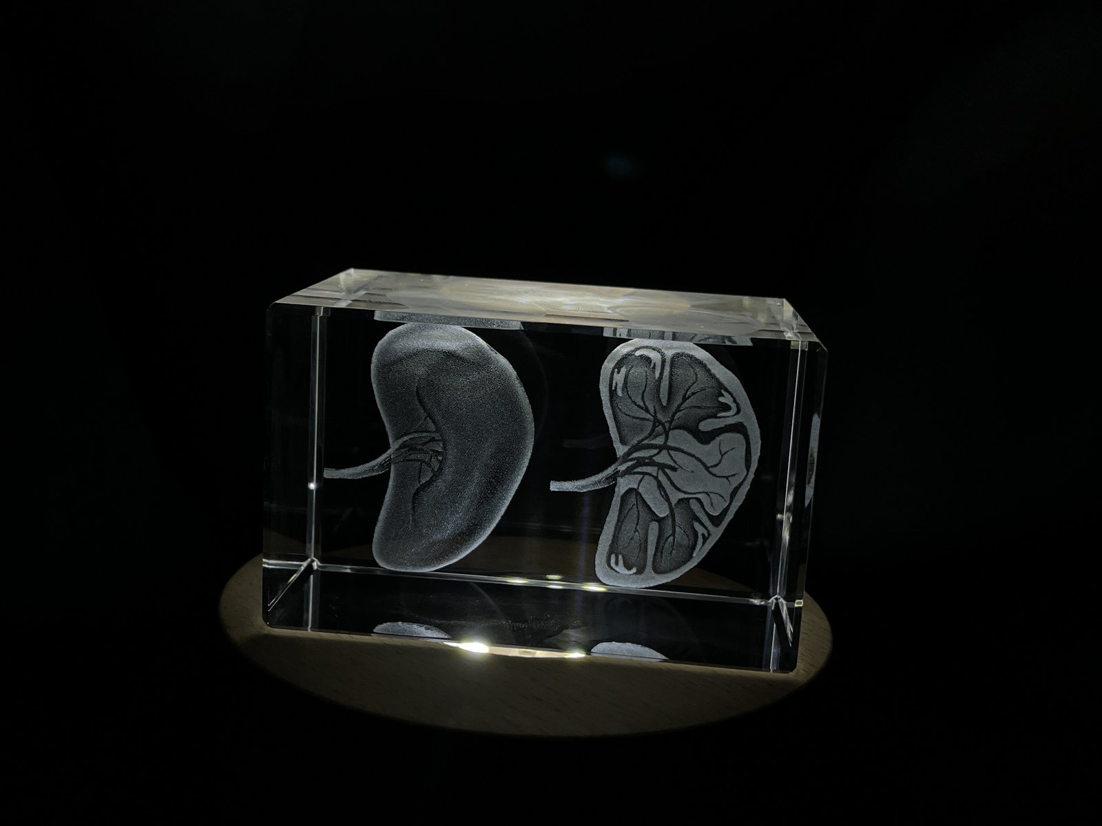 Spleen | 3D Engraved Crystal Keepsake | Gift/Decor | Collectible | Souvenir  | P