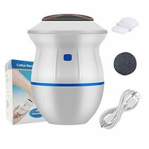 Portable Electric Vacuum Adsorption Foot Grinder - USB Electronic Foot Tools - $28.99